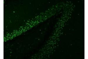 anti-Small Nuclear Ribonucleoprotein 27kDa (U4/U6.U5) (SNRNP27) (AA 100-155) antibody