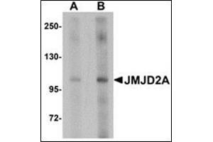Western blot analysis of JMJD2A in rat liver tissue lysate with this product at (A) 1 and (B) 2 μg/ml. (KDM4A Antikörper  (Center))