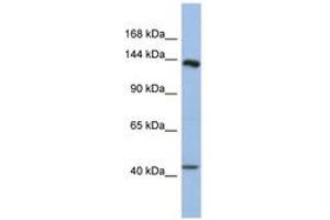 Image no. 1 for anti-Slit Homolog 1 (SLIT1) (AA 1439-1488) antibody (ABIN6744315) (SLIT1 Antikörper  (AA 1439-1488))