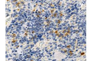 ABIN7093299 and ABIN7097318 at 1/100 staining Rat spleen tissue by IHC-P. (CD22 Antikörper  (pTyr807))