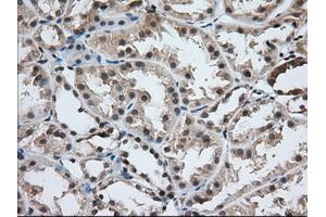 Immunohistochemical staining of paraffin-embedded Human prostate tissue using anti-USP5 mouse monoclonal antibody. (USP5 Antikörper)