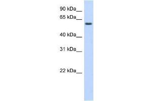 Western Blot showing KLHDC5 antibody used at a concentration of 1-2 ug/ml to detect its target protein. (KLHDC5 Antikörper  (Middle Region))