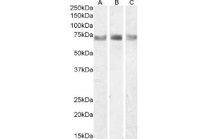 Western Blotting (WB) image for anti-IL2-Inducible T-Cell Kinase (ITK) (Internal Region) antibody (ABIN1589997)