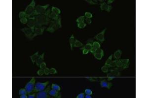 Immunofluorescence analysis of HeLa cells using Phospho-AKT(T308) Polyclonal Antibody at dilution of 1:100. (AKT1 Antikörper  (pThr308))