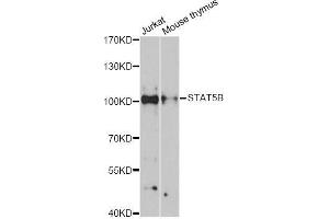 Western blot analysis of extracts of various cell lines, using STAT5B antibody (ABIN5998982) at 1:3000 dilution. (STAT5B Antikörper)