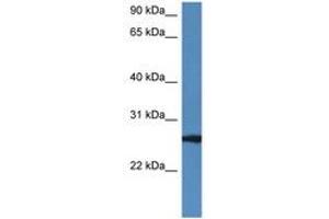 Image no. 1 for anti-RAB27B, Member RAS Oncogene Family (RAB27B) (AA 122-171) antibody (ABIN6747242) (RAB27B Antikörper  (AA 122-171))