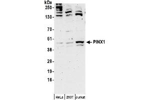 Western Blotting (WB) image for anti-PIN2/TERF1 Interacting, Telomerase Inhibitor 1 (PINX1) (AA 225-275) antibody (ABIN7455029)