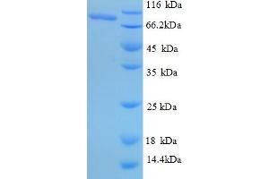 SDS-PAGE (SDS) image for NFKB Repressing Factor (NKRF) (AA 4-688), (partial) protein (His tag) (ABIN4976383) (NKRF Protein (AA 4-688, partial) (His tag))