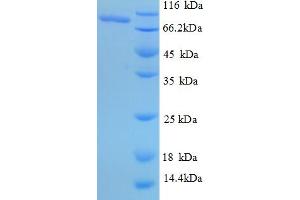 SDS-PAGE (SDS) image for NFKB Repressing Factor (NKRF) (AA 4-688), (partial) protein (His tag) (ABIN5710013)