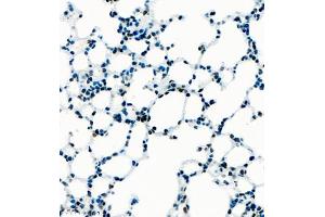 Immunohistochemistry of paraffin embedded mouse lung using UBE3A (ABIN7076104) at dilution of 1:1000 (400x lens) (ube3a Antikörper)
