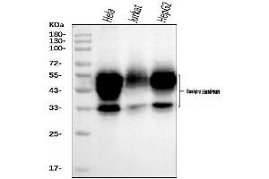 Western blot analysis of CD147/Emmprin using anti-CD147/Emmprin antibody (ABIN7599999). (CD147 Antikörper  (AA 138-323))