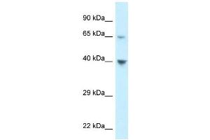 Western Blot showing CCRL1 antibody used at a concentration of 1 ug/ml against 293T Cell Lysate (CCRL1 Antikörper  (C-Term))