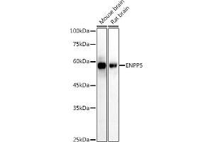 Western blot analysis of extracts of various cell lines, using (ABIN7266899) at 1:1000 dilution. (ENPP5 Antikörper)