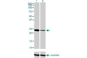 Western blot analysis of TWIST1 over-expressed 293 cell line, cotransfected with TWIST1 Validated Chimera RNAi (Lane 2) or non-transfected control (Lane 1).