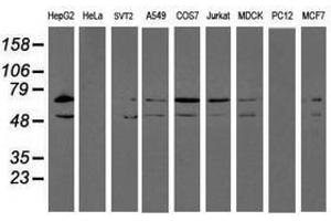 Image no. 2 for anti-Protein Disulfide Isomerase Family A, Member 4 (PDIA4) antibody (ABIN1500106) (PDIA4 Antikörper)