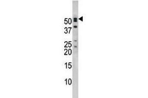 Image no. 2 for anti-Nucleoporin 50kDa (NUP50) (C-Term) antibody (ABIN357219) (NUP50 Antikörper  (C-Term))