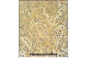 Immunohistochemistry (Paraffin-embedded Sections) (IHC (p)) image for anti-Cytochrome P450, Family 2, Subfamily A, Polypeptide 7 (CYP2A7) (AA 121-148) antibody (ABIN654434)