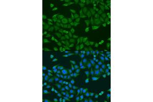 Immunofluorescence analysis of U2OS cells using RPS27A antibody. (RPS27A Antikörper  (AA 1-156))