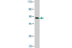 Western Blot detection against Immunogen (53. (DREAM Antikörper  (AA 1-256))