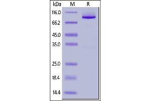 SDS-PAGE (SDS) image for Glypican 1 (GPC1) (AA 24-530) (Active) protein (Fc Tag) (ABIN6938876)