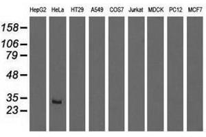 Image no. 1 for anti-Glutathione S-Transferase theta 2 (GSTT2) antibody (ABIN1498559) (GSTT2 Antikörper)
