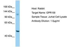 Image no. 1 for anti-G Protein-Coupled Receptor 158 (GPR158) (AA 1120-1169) antibody (ABIN6750189) (GPR158 Antikörper  (AA 1120-1169))