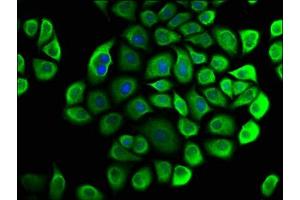 Immunofluorescence staining of Hela cells with ABIN7147101 at 1:33, counter-stained with DAPI. (CNOT3 Antikörper  (AA 257-395))