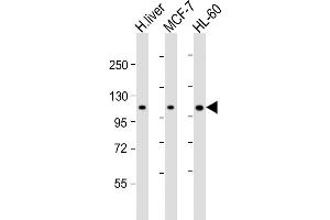All lanes : Anti-RSBN1 Antibody (N-term) at 1:2000 dilution Lane 1: human liver lysate Lane 2: MCF-7 whole cell lysate Lane 3: HL-60 whole cell lysate Lysates/proteins at 20 μg per lane. (RSBN1 Antikörper  (N-Term))