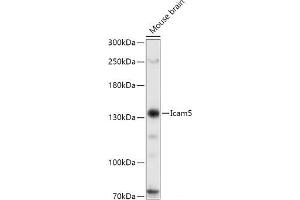 Western blot analysis of extracts of Mouse brain using Icam5 Polyclonal Antibody at dilution of 1:1000. (ICAM5 Antikörper)
