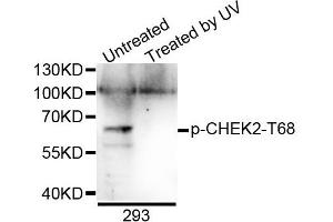 Western blot analysis of extracts of 293 cells, using Phospho-CHEK2-T68 antibody. (CHEK2 Antikörper  (pThr68))