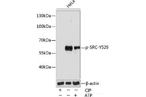 Western blot analysis of extracts of various cell lines using Phospho-SRC(Y529) Polyclonal Antibody at dilution of 1:1000. (Src Antikörper  (pTyr529))