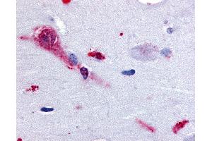 Anti-TAAR1 antibody IHC of human brain, amygdala. (TAAR1 Antikörper  (Cytoplasmic Domain))