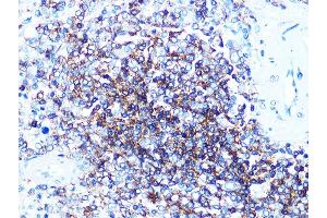 Immunohistochemistry (IHC) image for anti-Membrane-Spanning 4-Domains, Subfamily A, Member 1 (MS4A1) antibody (ABIN7268472)