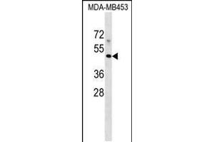 Western blot analysis in MDA-MB453 cell line lysates (35ug/lane). (MR1 Antikörper  (C-Term))
