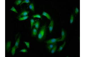 Immunofluorescence staining of Hela cells with ABIN7152702 at 1:166, counter-stained with DAPI. (FERMT2 Antikörper  (AA 155-232))