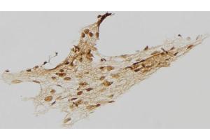 ABIN6273458 at 1/100 staining Human gastric tissue by IHC-P.