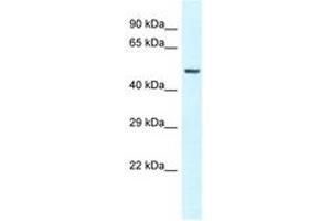 Image no. 1 for anti-Vitamin D-Binding Protein (GC) (AA 70-119) antibody (ABIN6747593)