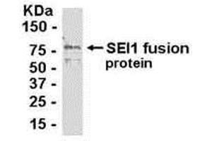 Western Blotting (WB) image for anti-SERTA Domain Containing 1 (SERTAD1) (AA 1-236) antibody (ABIN2468083)