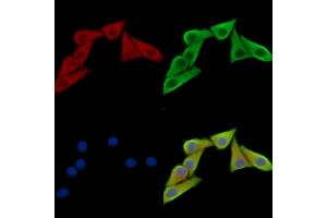 ABIN7095240 and ABIN7099297 staining Hela cells by IF/ICC.