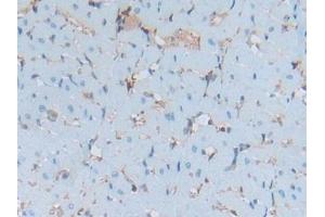 DAB staining on IHC-P; Samples: Rat Heart Tissue (S100A6 Antikörper  (AA 1-89))