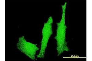 Immunofluorescence of monoclonal antibody to LMO4 on HeLa cell. (LMO4 Antikörper  (AA 1-165))