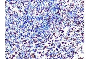 Immunohistochemistry of paraffin-embedded human appendix using S Rabbit mAb (ABIN7270142) at dilution of 1:100 (40x lens). (SAMHD1 Antikörper)