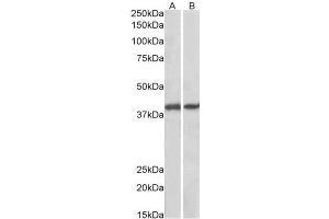AP23750PU-N GNAQ antibody staining of Pig Colon (A) and Pig Spleen (B) lysates at 0. (GNAQ Antikörper  (Internal Region))