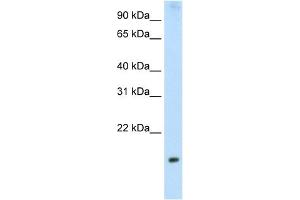 WB Suggested Anti-PPP1R8 Antibody Titration:  2. (PPP1R8 Antikörper  (Middle Region))