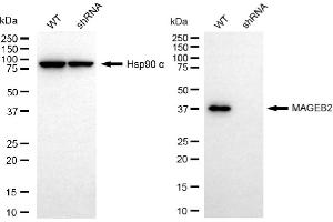 anti-Melanoma Antigen Family B, 2 (MAGEB2) antibody