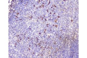 IHC analysis of CXCL12 using anti-CXCL12 antibody (ABIN6719467).