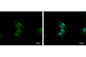 ICC/IF Image Calcineurin A antibody detects Calcineurin A protein at nucleus by immunofluorescent analysis. (Calcineurin A Antikörper  (Center))