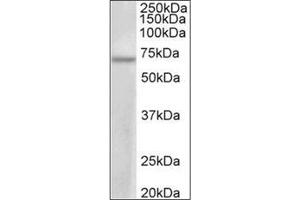 PRMT3 Antibody  staining of MCF7 lysate at 1 μg/ml (35 μg protein in RIPA buffer). (PRMT3 Antikörper  (Internal Region))