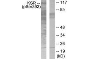 Western blot analysis of extracts from HepG2 cells, using KSR (Phospho-Ser392) Antibody. (KSR1 Antikörper  (pSer404))