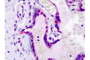 Immunohistochemistry (IHC) image for anti-Leo1, Paf1/RNA Polymerase II Complex Component, Homolog (S. Cerevisiae) (LEO1) (pSer10) antibody (ABIN6745768)
